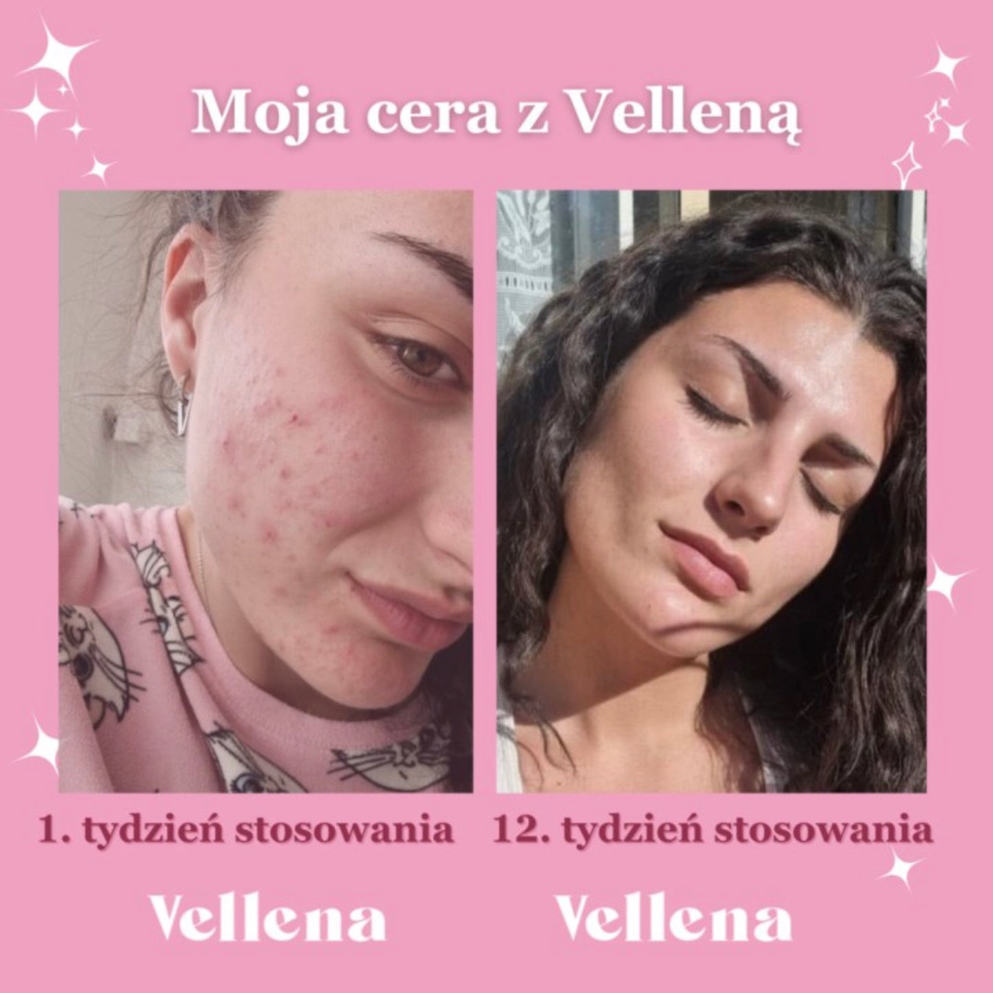 Zdrowie hormonalne | Napój dla kobiet | Wiśnia