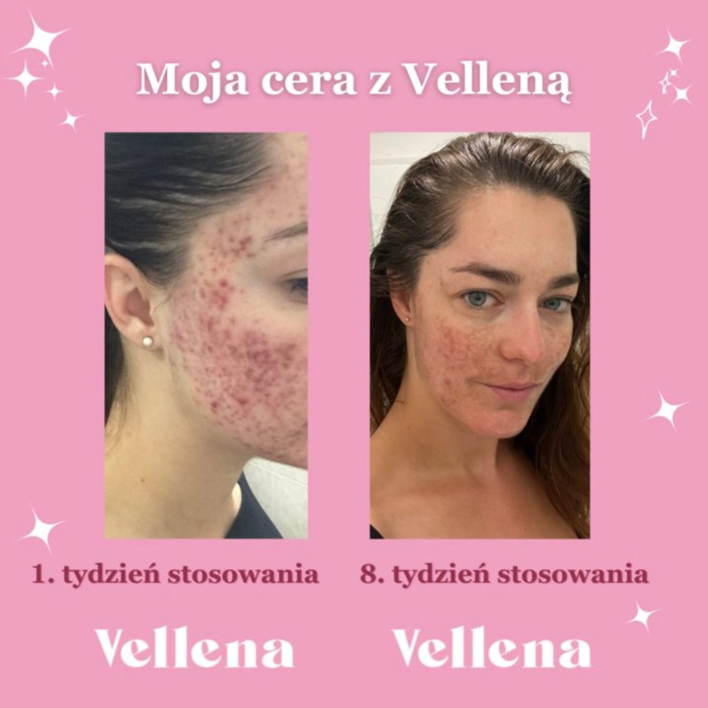Zdrowie hormonalne | Napój dla kobiet | Brzoskwinia