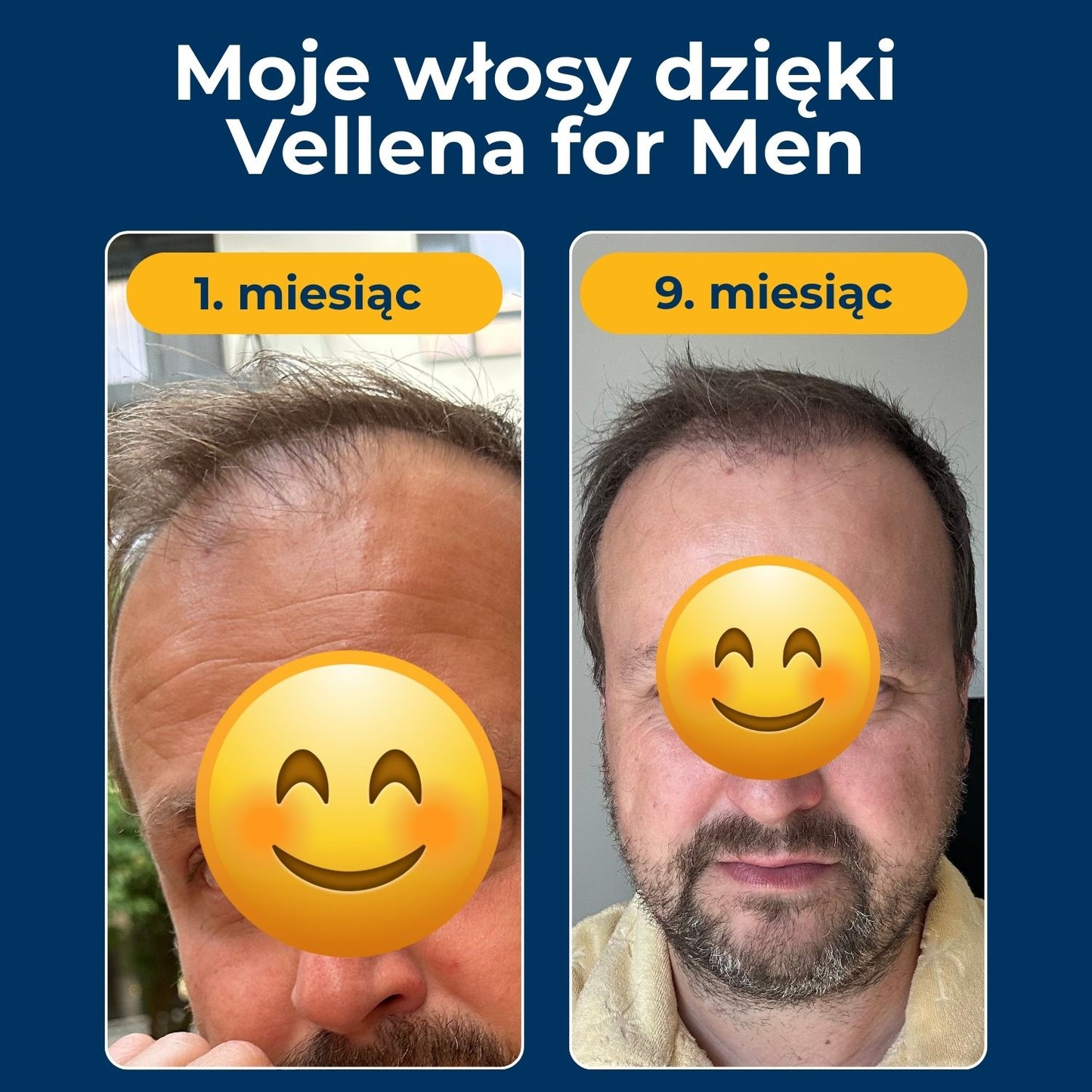 Męskie zdrowie | Kapsułki 2-PACK | Vellena for Men