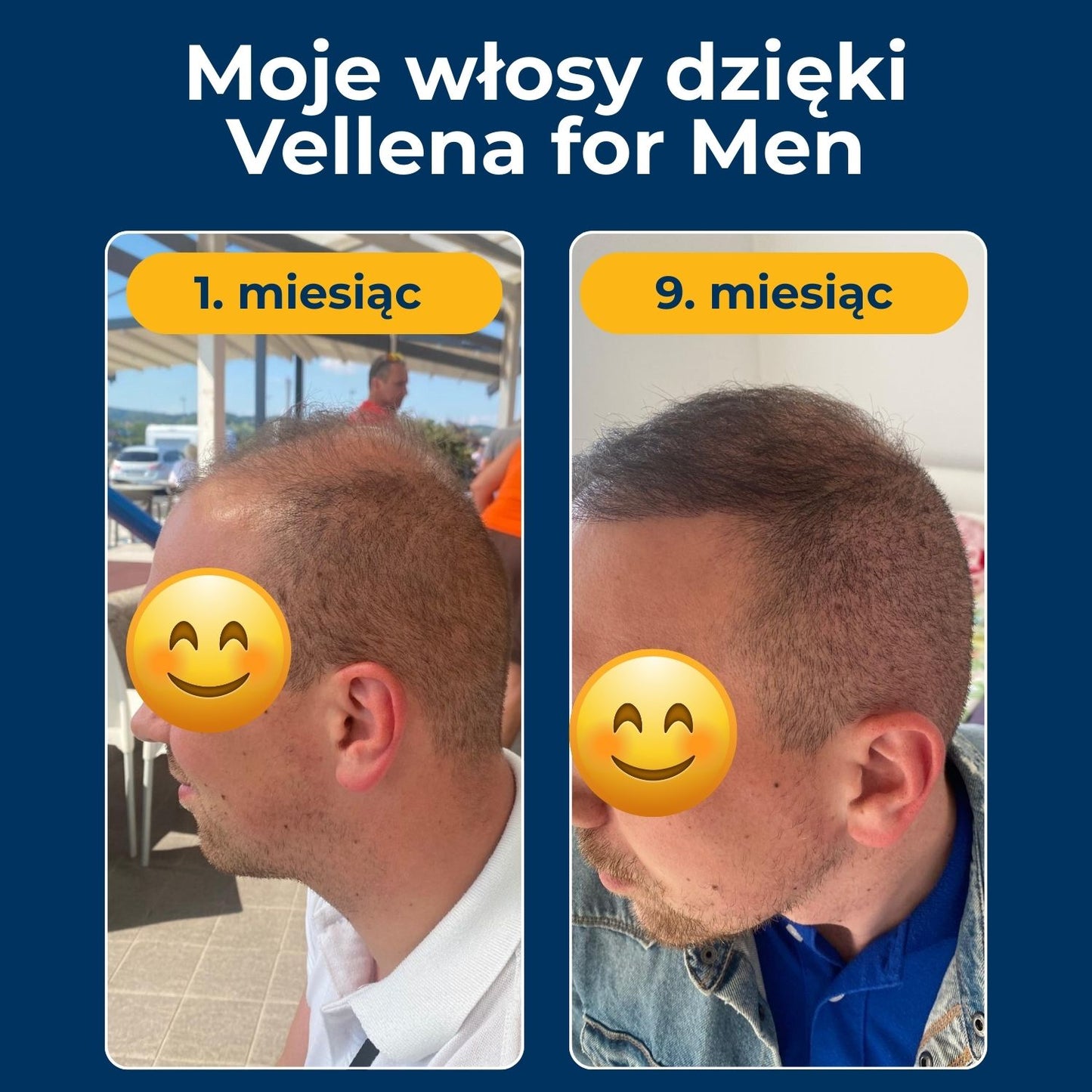 Męskie zdrowie | Kapsułki 2-PACK | Vellena for Men