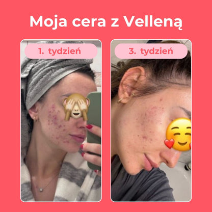 Kobiece zdrowie | Kapsułki 3-PACK + torba GRATIS | Vellena