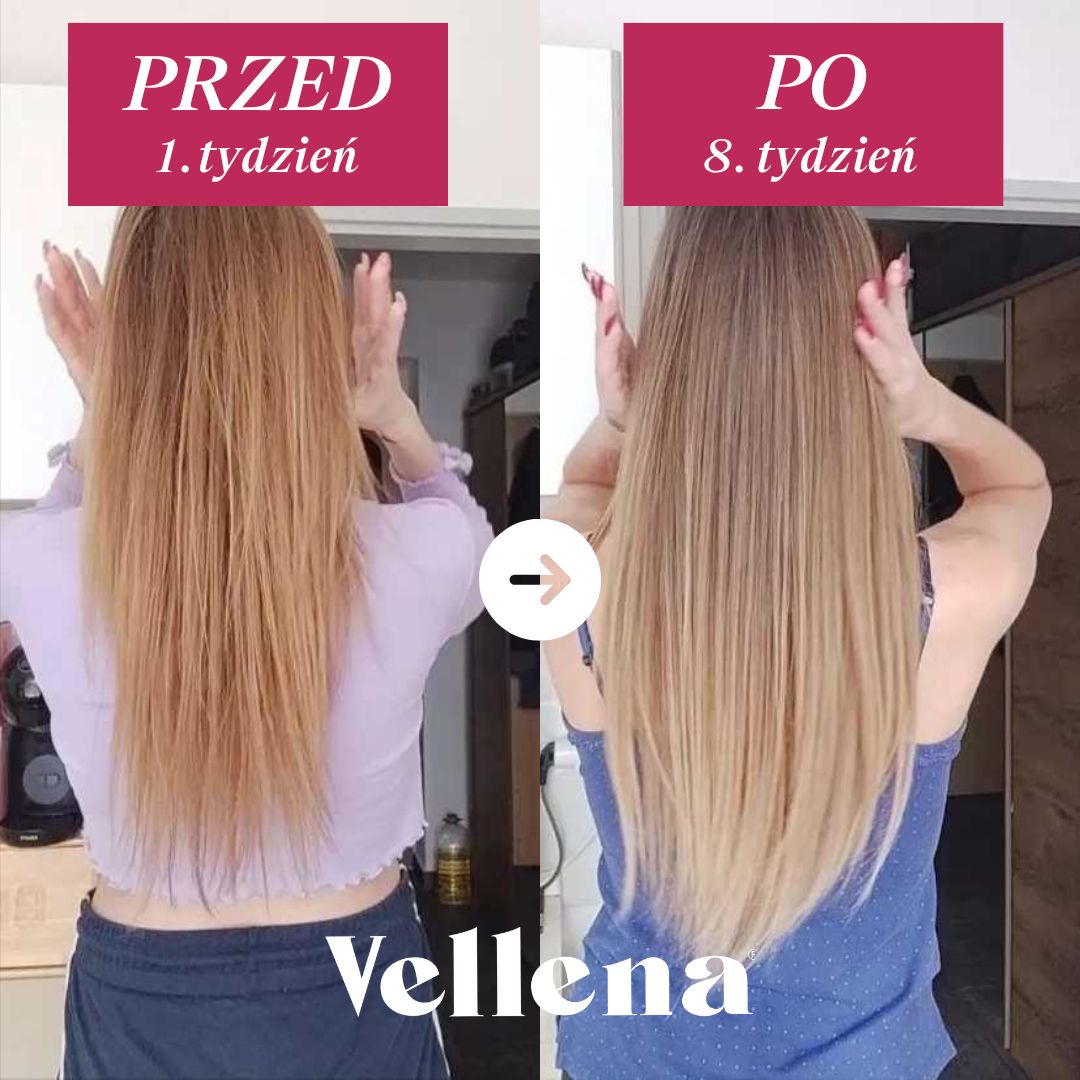 Kobiece zdrowie | Napój 2-PACK | Wiśnia | Vellena