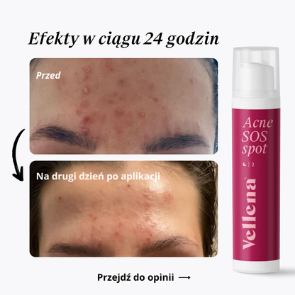 Acne SOS spot 15ml | Vellena